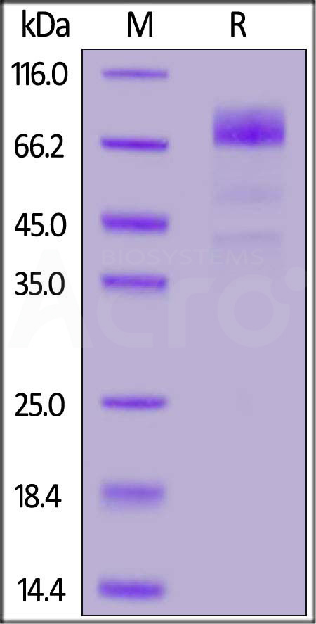Biotinylated Human CD36, His,Avitag (Cat. No. CD6-H82E9) SDS-PAGE gel