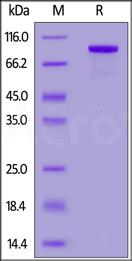 Human CD32b/c, HSA,His Tag (Cat. No. CDB-H52S9) SDS-PAGE gel