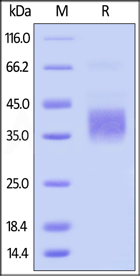 Biotinylated Mouse CD32b, Avitag,His Tag (Cat. No. CDB-M82E8) SDS-PAGE gel