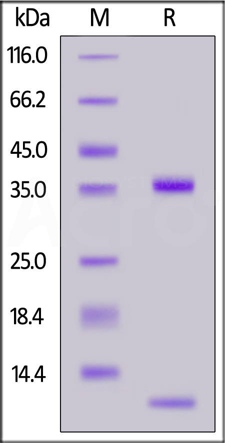 Biotinylated Bovine FcRn Heterodimer Protein, His,Avitag (Cat. No. FCN-B82W3) SDS-PAGE gel