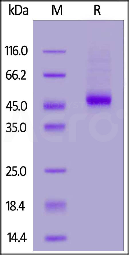 Canine IL-3 R alpha, His Tag (Cat. No. ILA-C52H3) SDS-PAGE gel