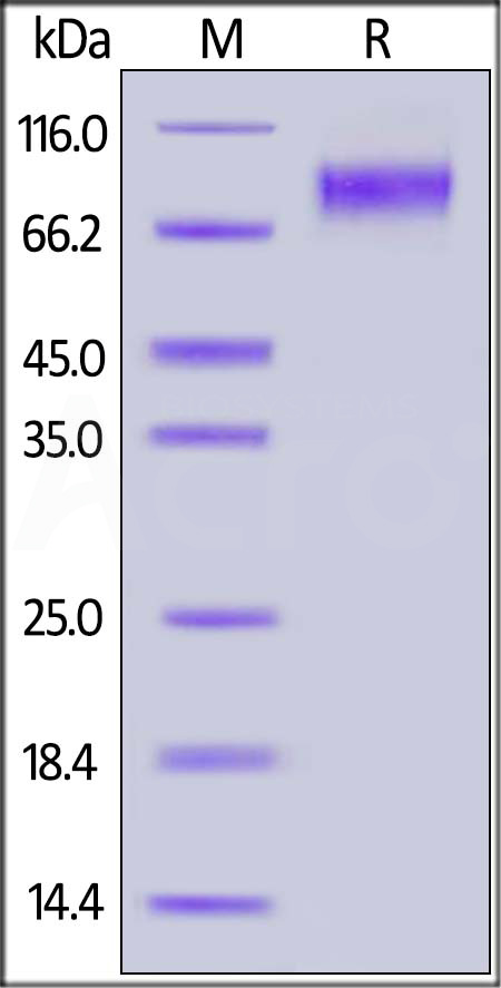 Human IL-2 R gamma, Fc Tag (Cat. No. ILG-H5256) SDS-PAGE gel