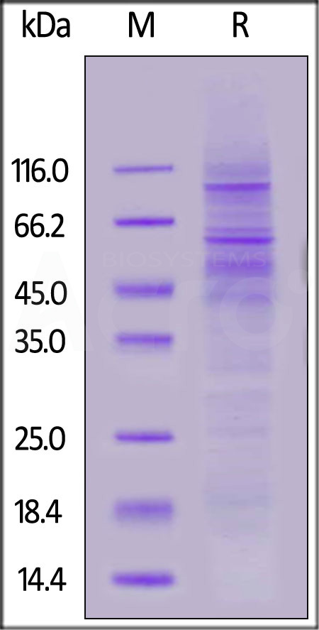 Human PD-1 Full Length, His Tag (Cat. No. PD1-H52H6) SDS-PAGE gel