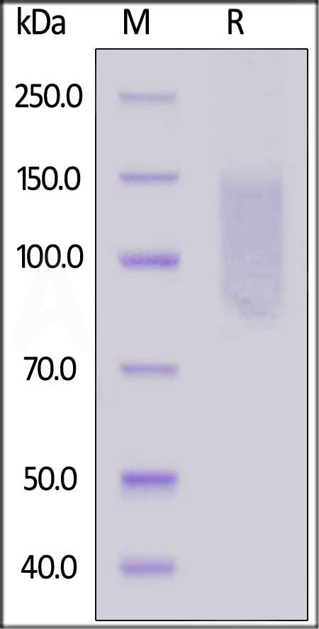 Human CD96 (C110S), His Tag (Cat. No. TAE-H52H0) SDS-PAGE gel