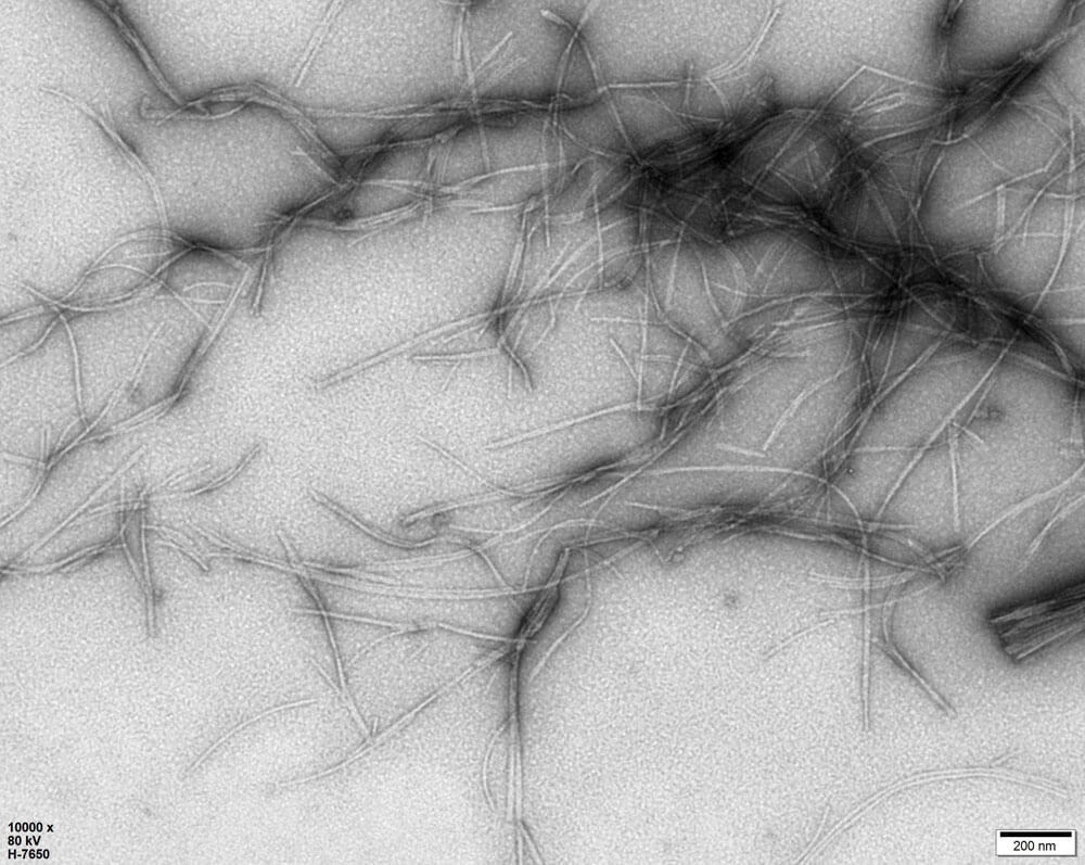 Alpha-Synuclein ELECTRON MICROSCOPE