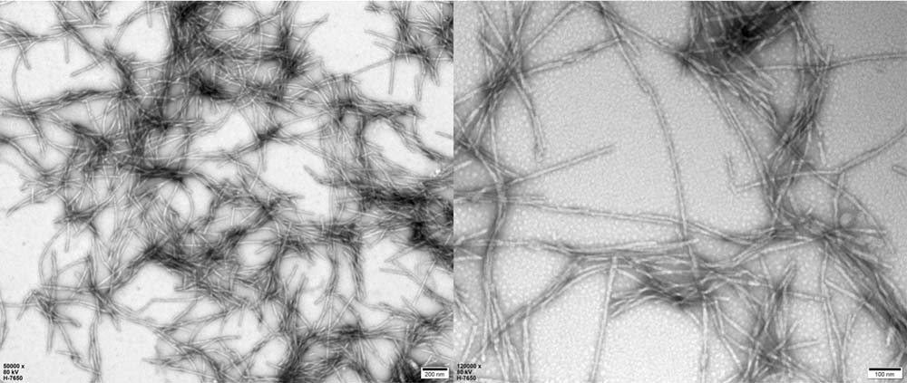 Alpha-Synuclein ELECTRON MICROSCOPE