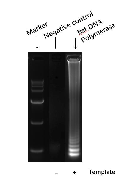 DNA polymerase I ENZYME