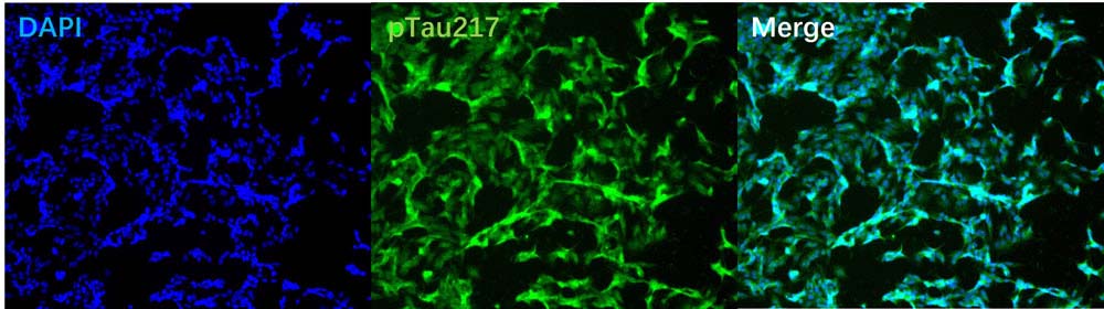 Tau IMMUNOFLUORESCENCE