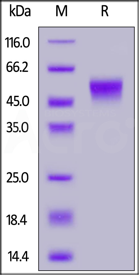 Human CD16b (NA2), SUMO,His Tag (Cat. No. CDB-H5294) SDS-PAGE gel