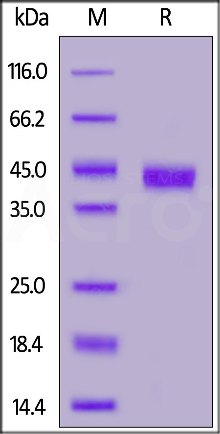 Human CD32b/c, SUMO,His Tag (Cat. No. CDB-H5298) SDS-PAGE gel
