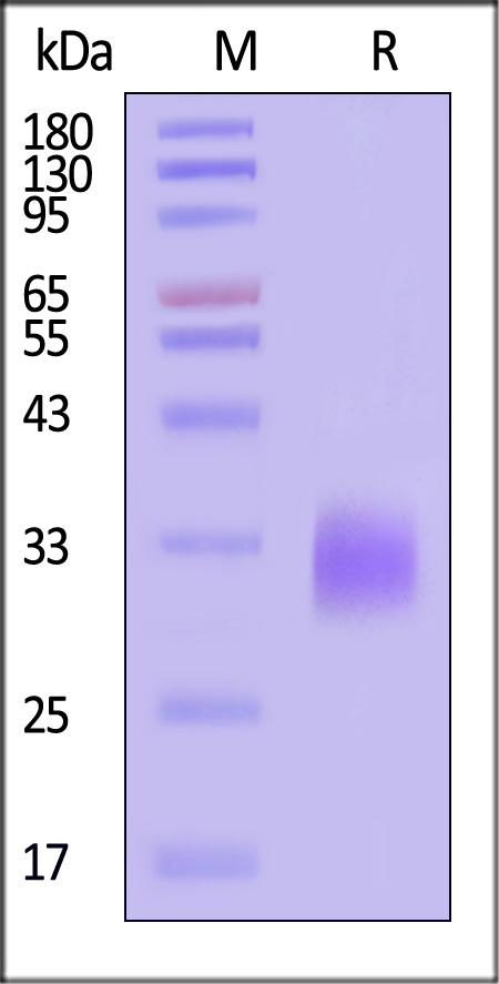 DR3 SDS-PAGE