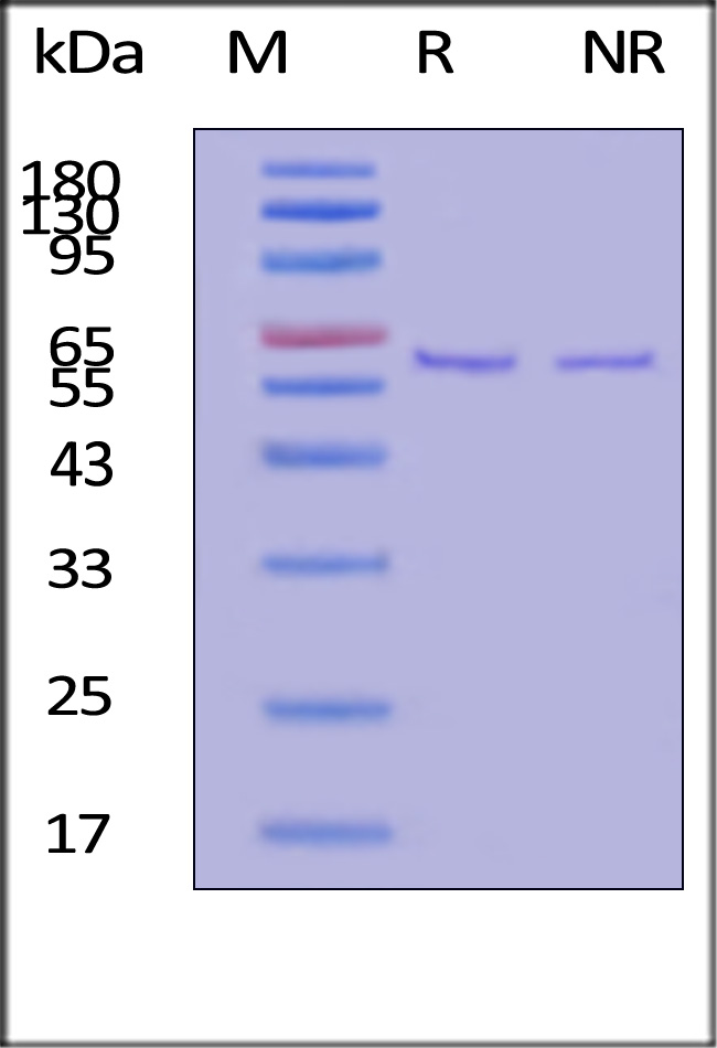 Fibronectin SDS-PAGE