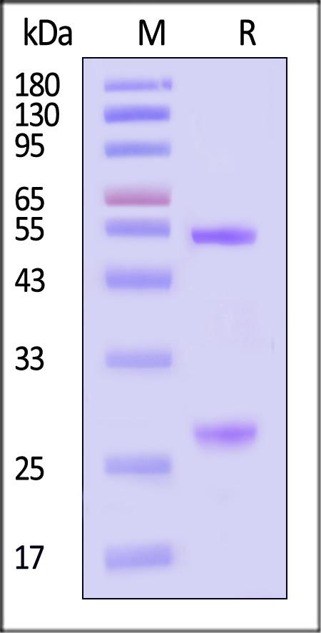 Hemagglutinin/HA (Influenza Virus) SDS-PAGE