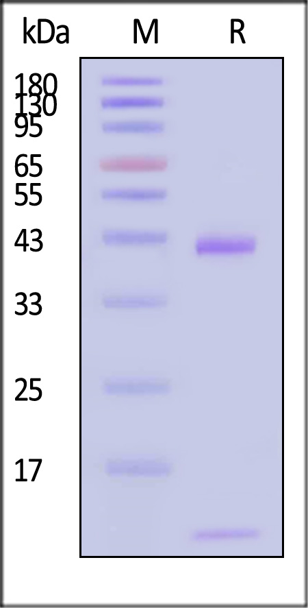 HLA-A*0201 & B2M & EBV EBNA3C (LLDFVRFMGV) SDS-PAGE