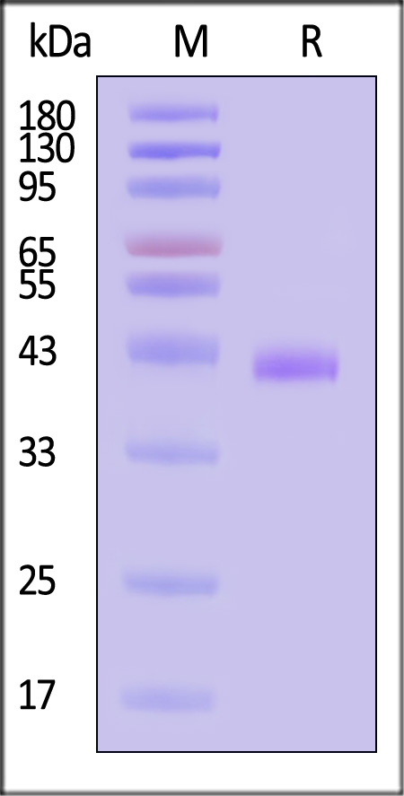 HLA-A*1101 & B2M & MAGE-A1 (SLFRAVITK) SDS-PAGE