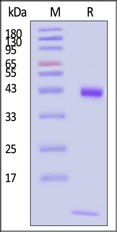 HLA-A*1101 & B2M & KRASG12R (VVVGARGVGK) SDS-PAGE