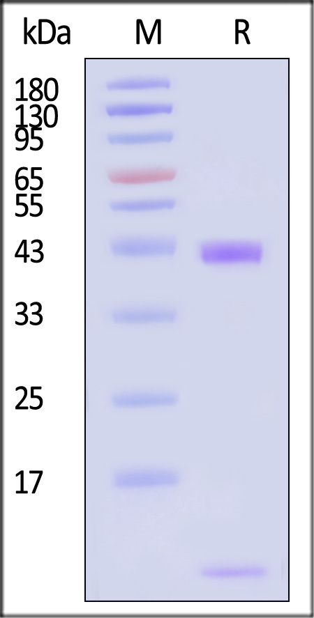 HLA-A*1101 & B2M & EGF R (KITDFGRAK) SDS-PAGE