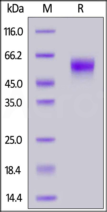 Human IL-2 R gamma, His Tag (Cat. No. ILA-H52H5) SDS-PAGE gel