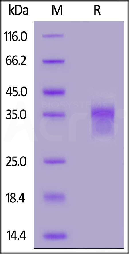 FITC-Labeled Human LILRB4, His Tag (Cat. No. LI4-HF2H3) SDS-PAGE gel