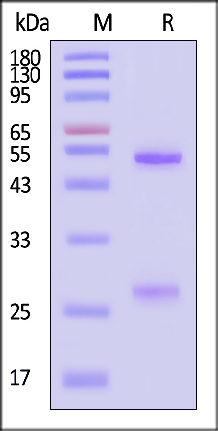 Neuraminidase/NA (Influenza Virus) SDS-PAGE