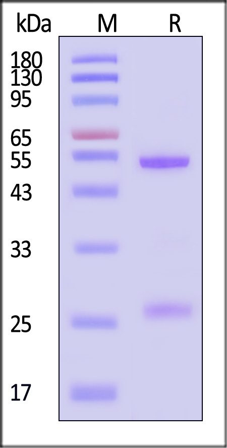 Neuraminidase/NA (Influenza Virus) SDS-PAGE