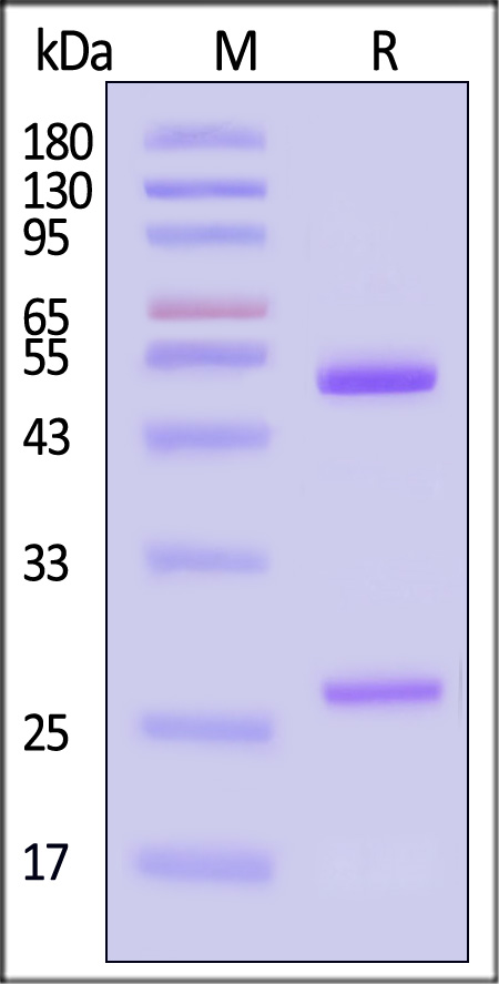 Neuraminidase/NA (Influenza Virus) SDS-PAGE