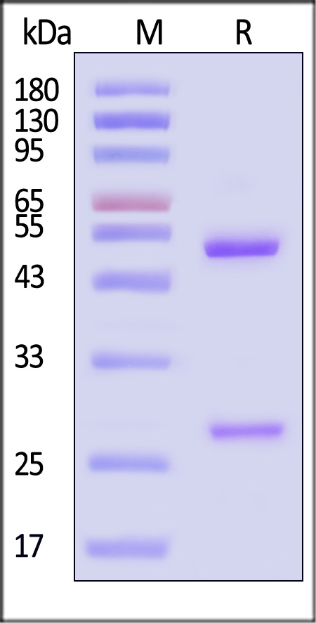 Neuraminidase/NA (Influenza Virus) SDS-PAGE