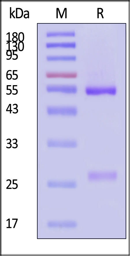 pre-Gc protein SDS-PAGE