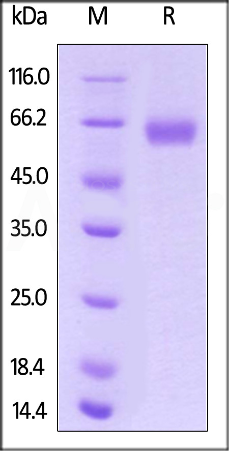 ROR1 SDS-PAGE