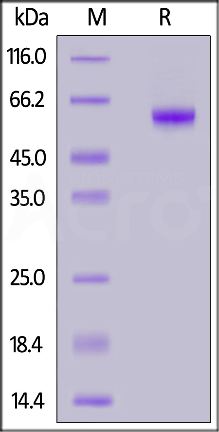 ROR1 SDS-PAGE