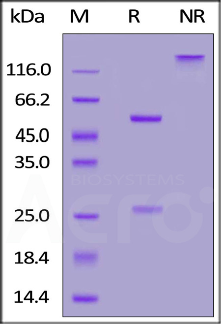 Anti-SARS-CoV-2 Spike RBD Antibody, Chimeric mAb, Human IgG1 (AM130) (Cat. No. S1N-M13A1) SDS-PAGE gel