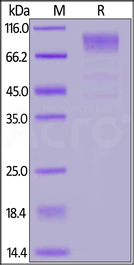 HCoV-229E S1 protein, His Tag (Cat. No. SIN-V52H4) SDS-PAGE gel