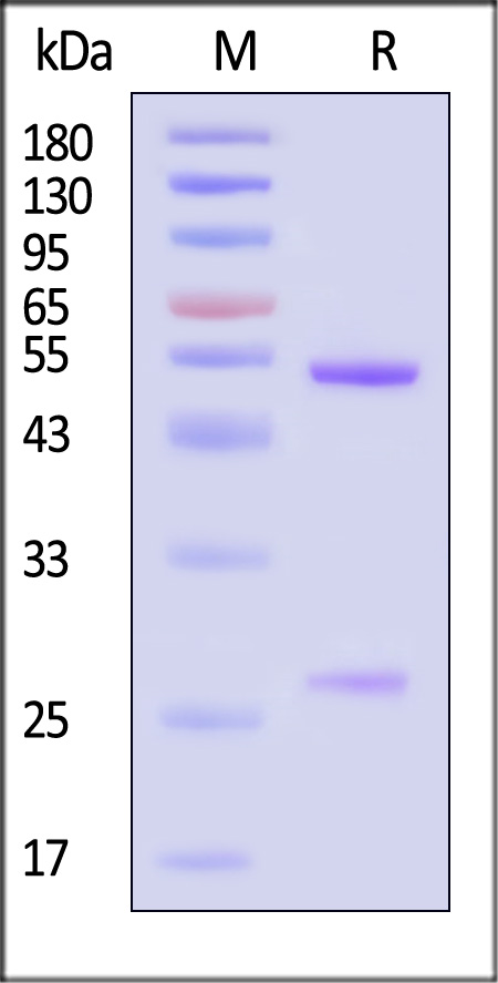 VP0 (Coxsackievirus A16) SDS-PAGE