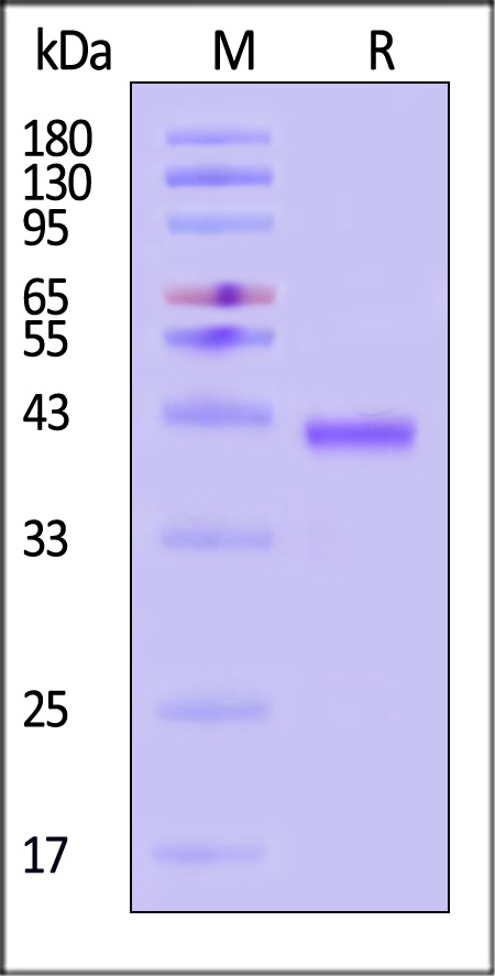 WRN SDS-PAGE