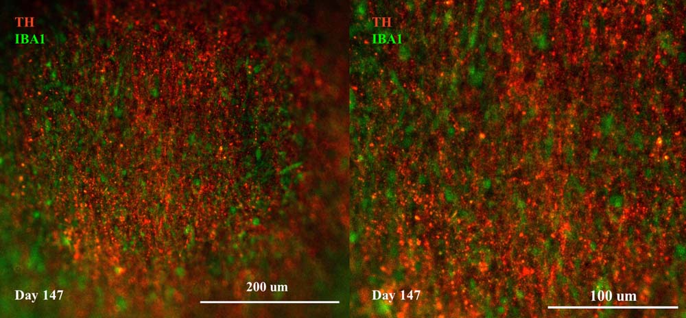 Organoids MARKER EXPRESSION