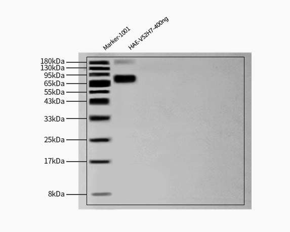 Hemagglutinin/HA (Influenza Virus) WESTERN BLOT