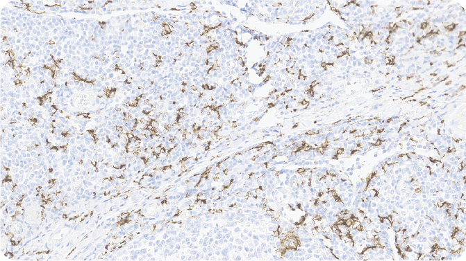 扁桃体 CD163 20X (HGS-S243)
