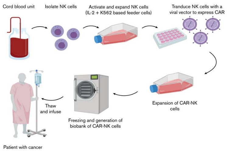  自体CAR-NK细胞的疗法基本流程 