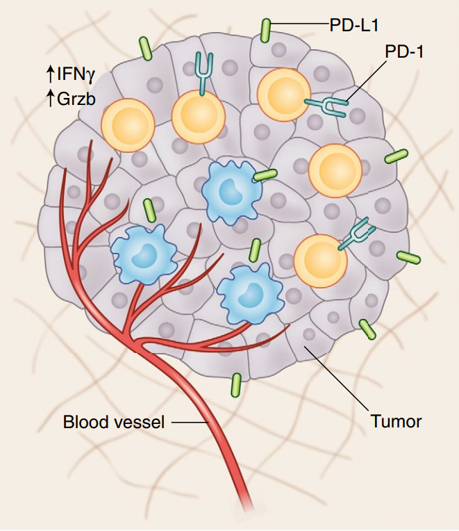 肿瘤组织中的TIL细胞