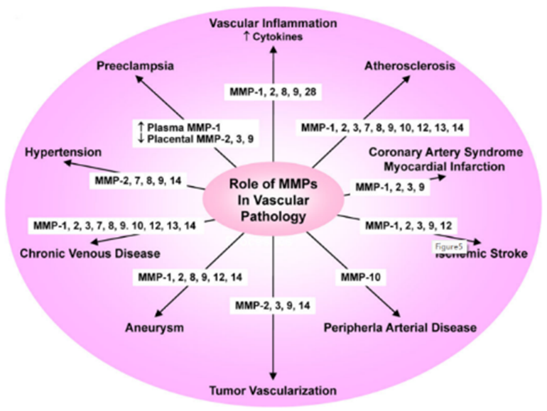 MMPs在血管病理学中的作用