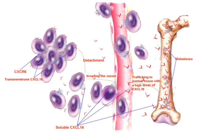 CXCR6–CXCL16轴在癌症转移中的作用示意图
