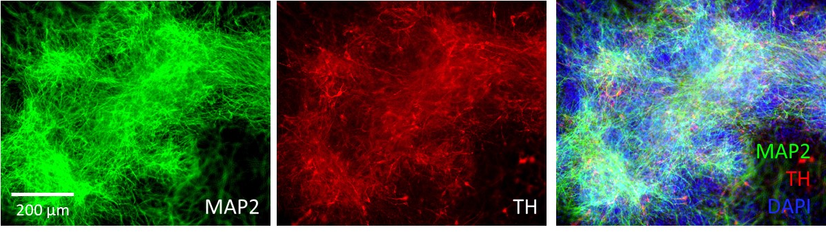 Aneuro联合Organoid Toolbox助您解码帕金森病新前沿