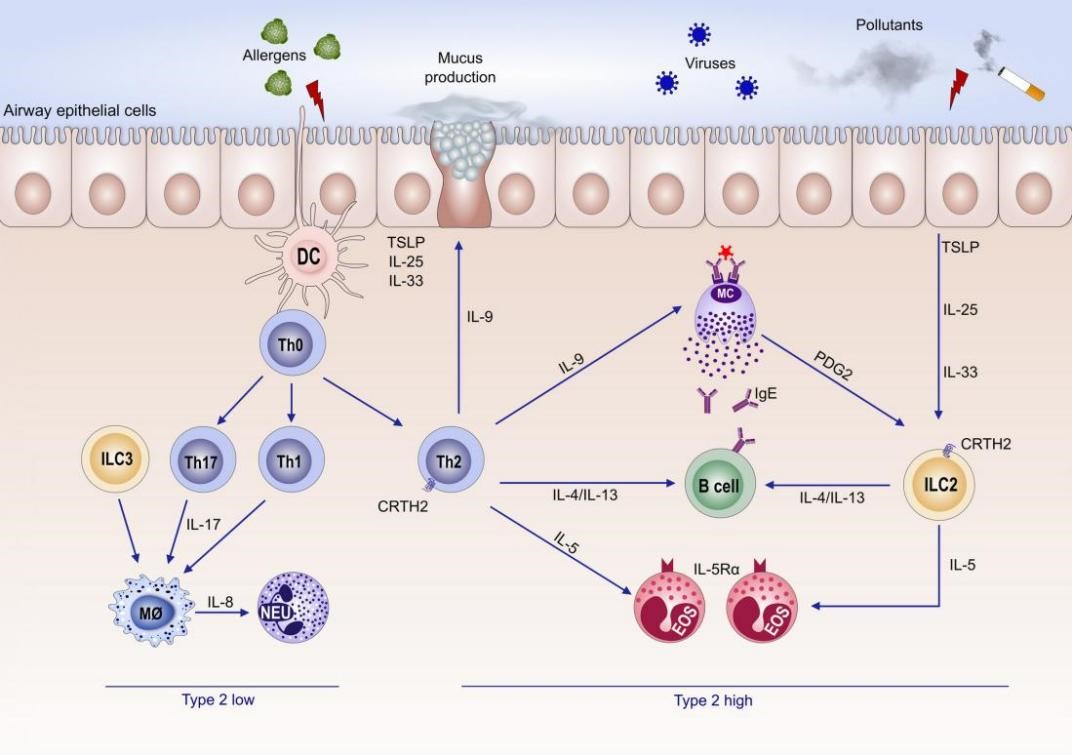 2型低度哮喘与2型高度哮喘的发病机制
